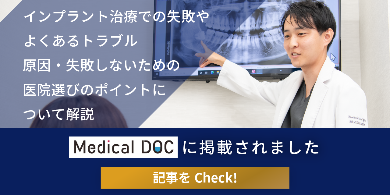 MedicalDOC インプラント治療での失敗やよくあるトラブル